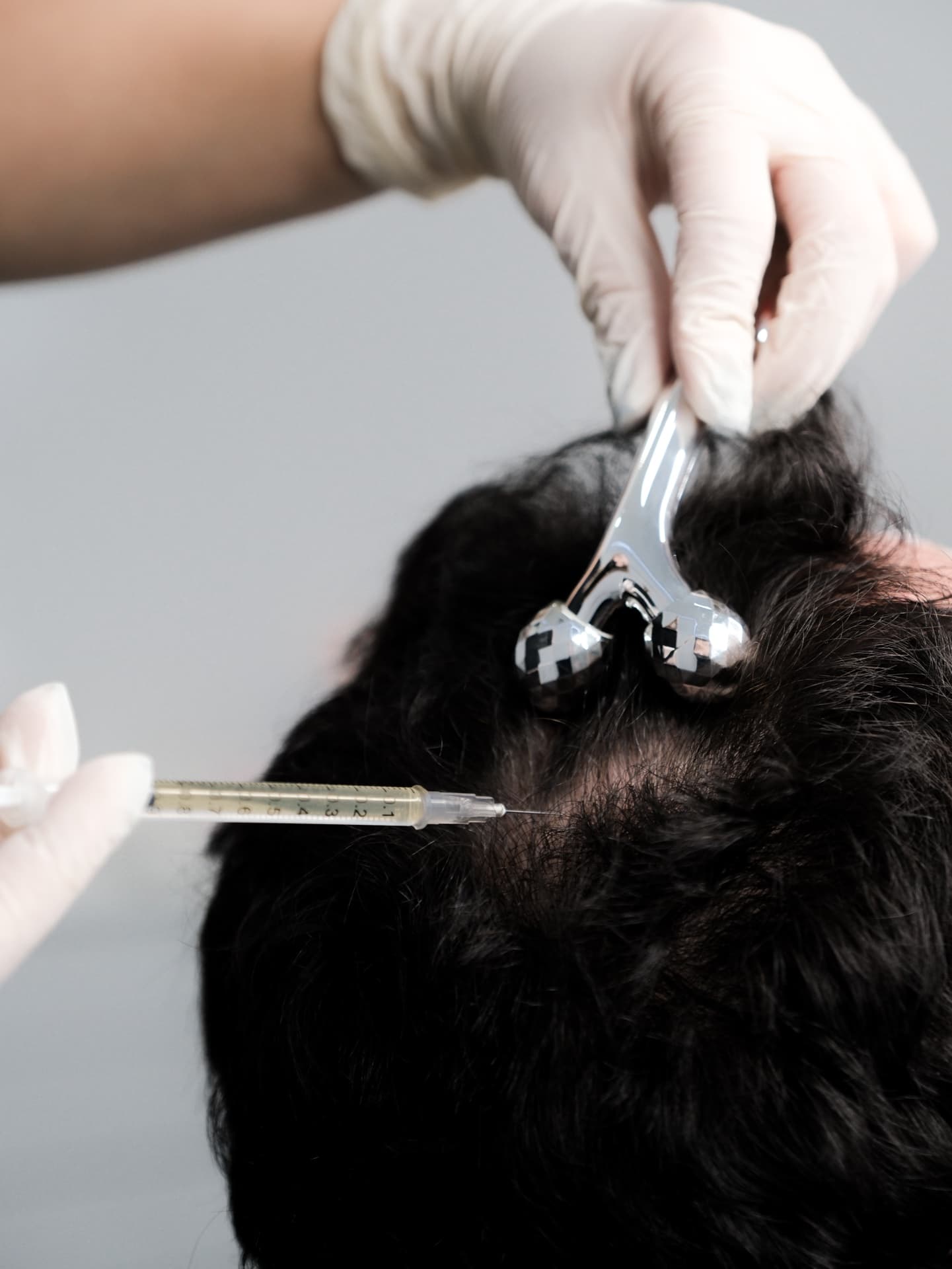 PRP Rigenerativo — European Dental Clinic Tirana