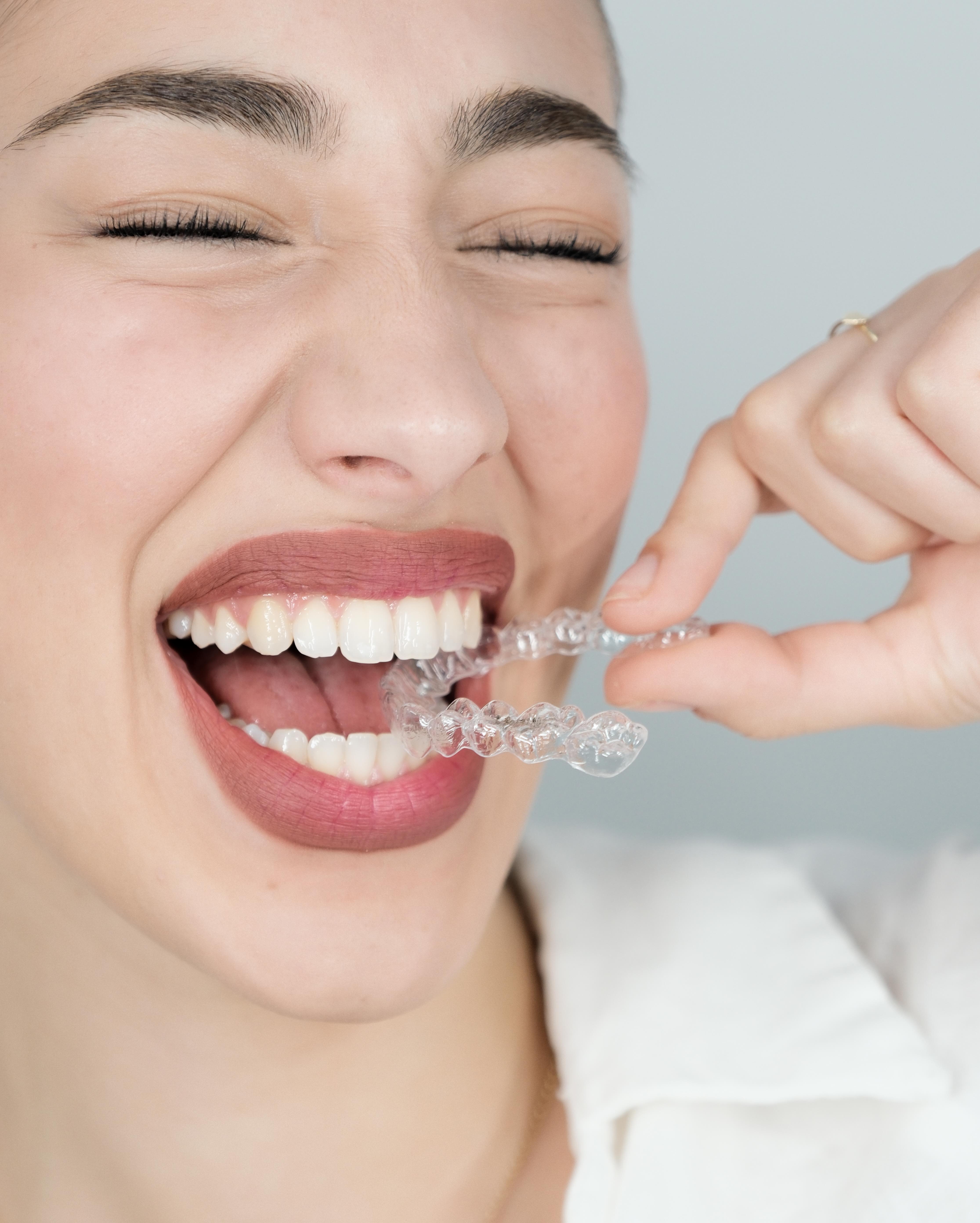 Home Aligner Care