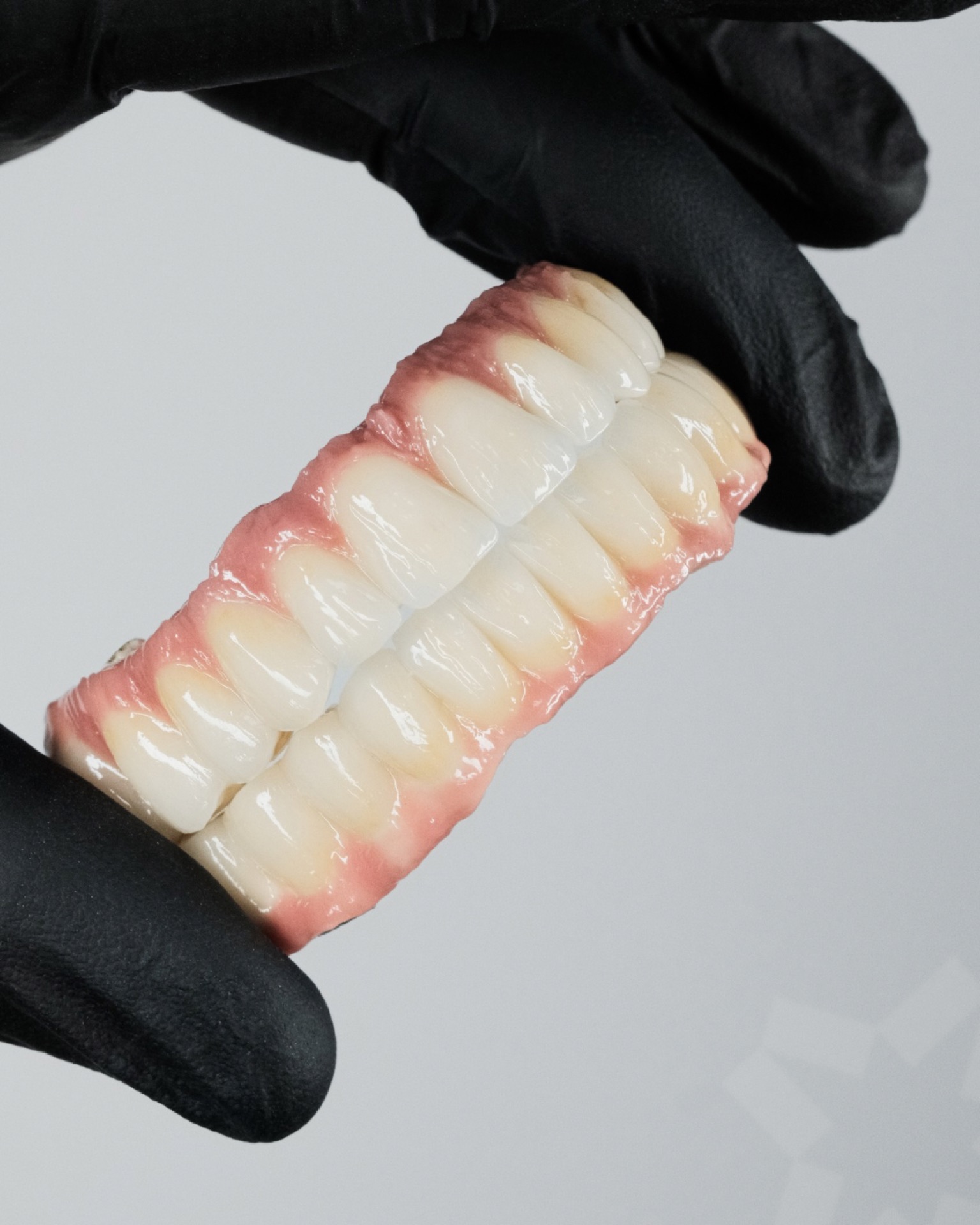 Dental Prosthetics
