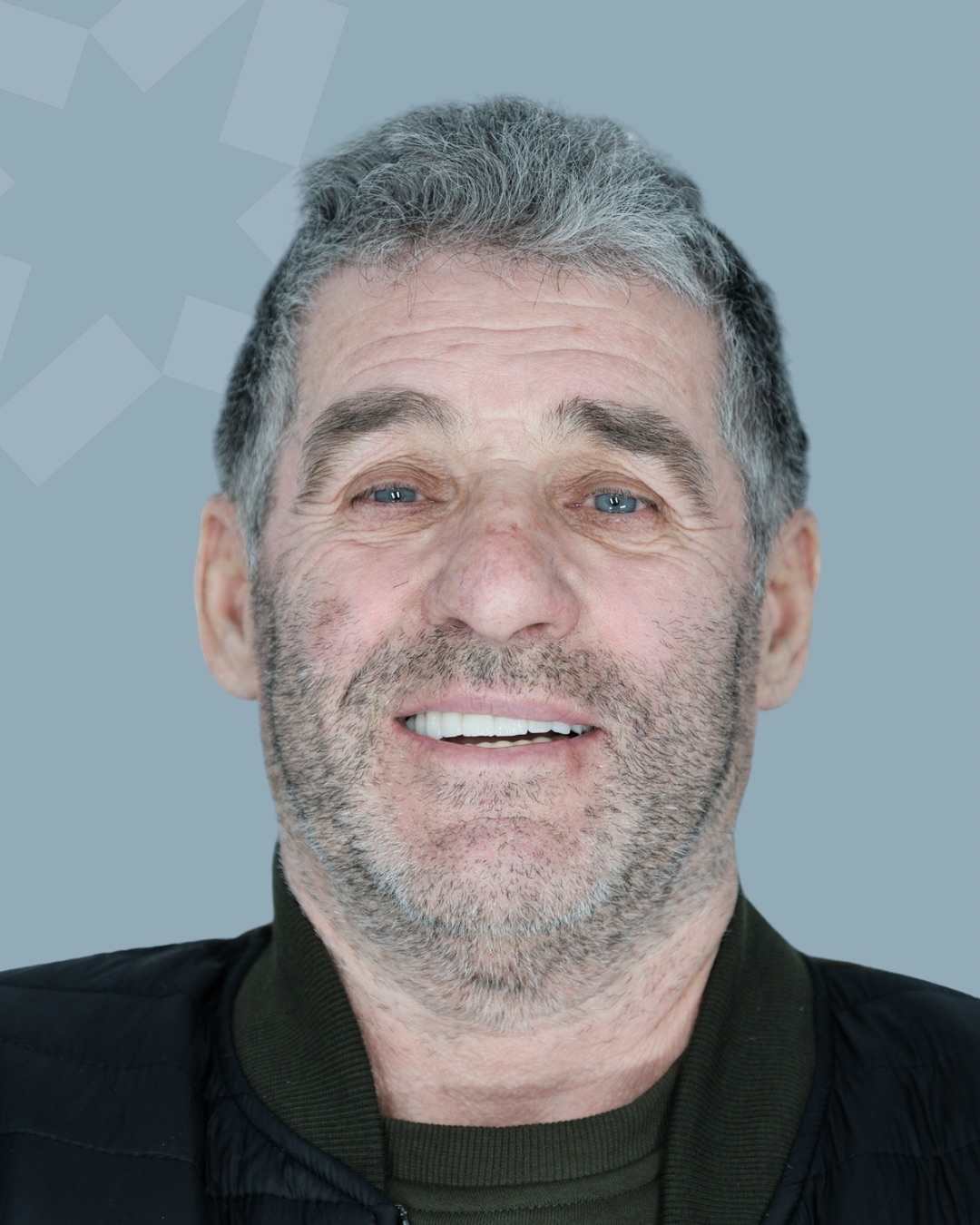 Sorriso dopo riabilitazione implantare — impianto post-estrattivo immediato a Tirana