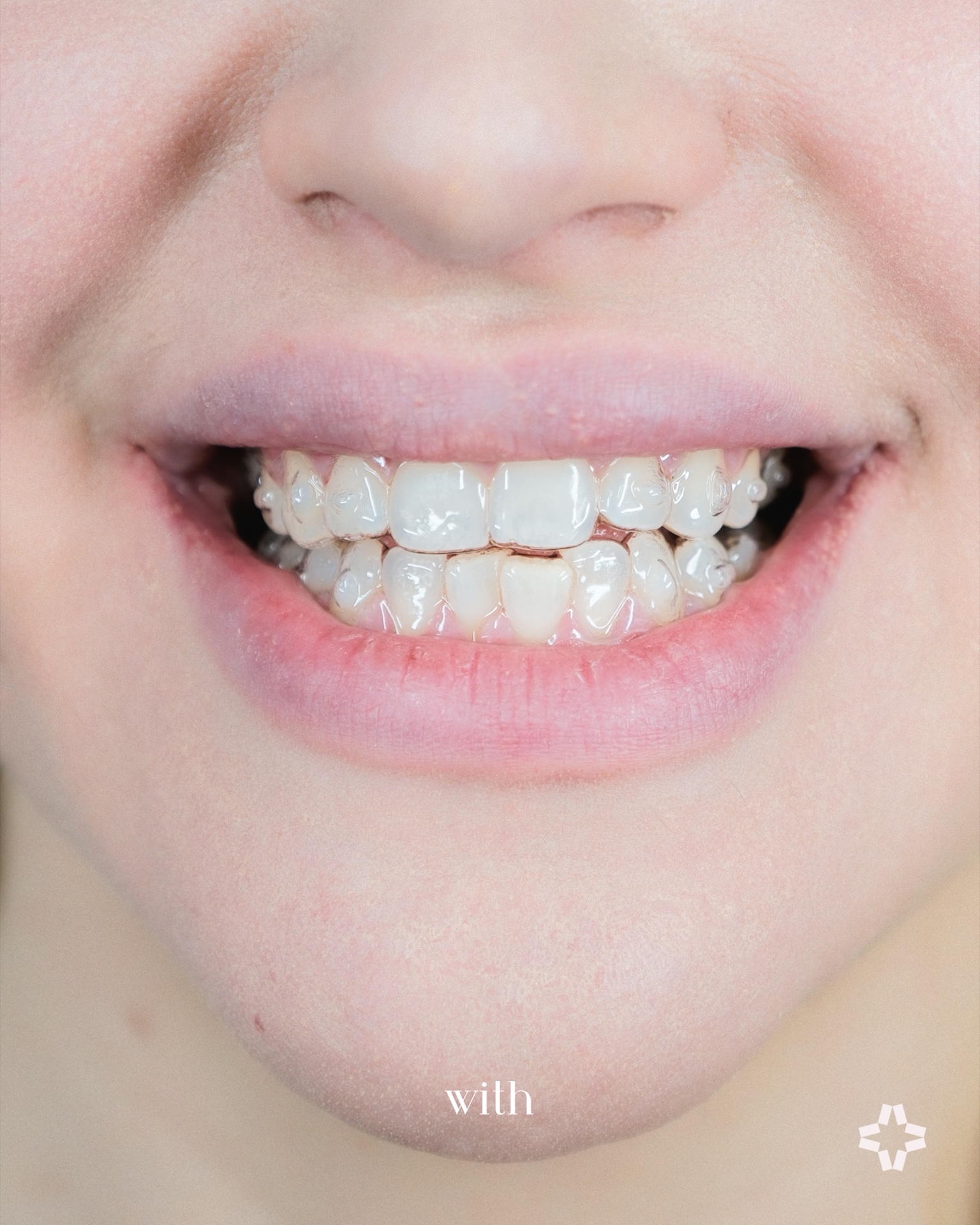 Dena — Nuvola close-up