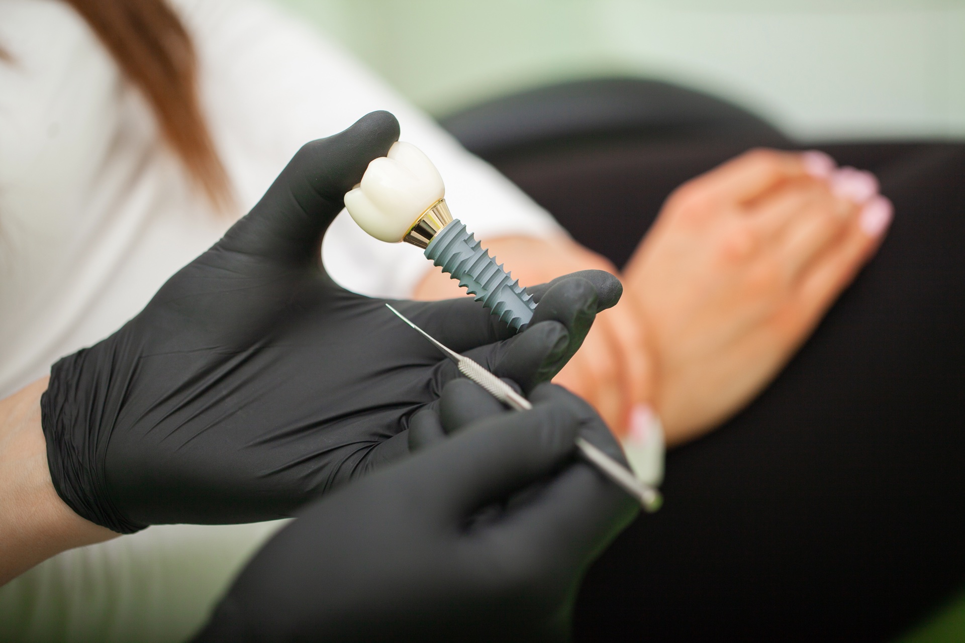 Consulenza turismo dentale Tirana — European Dental Clinic
