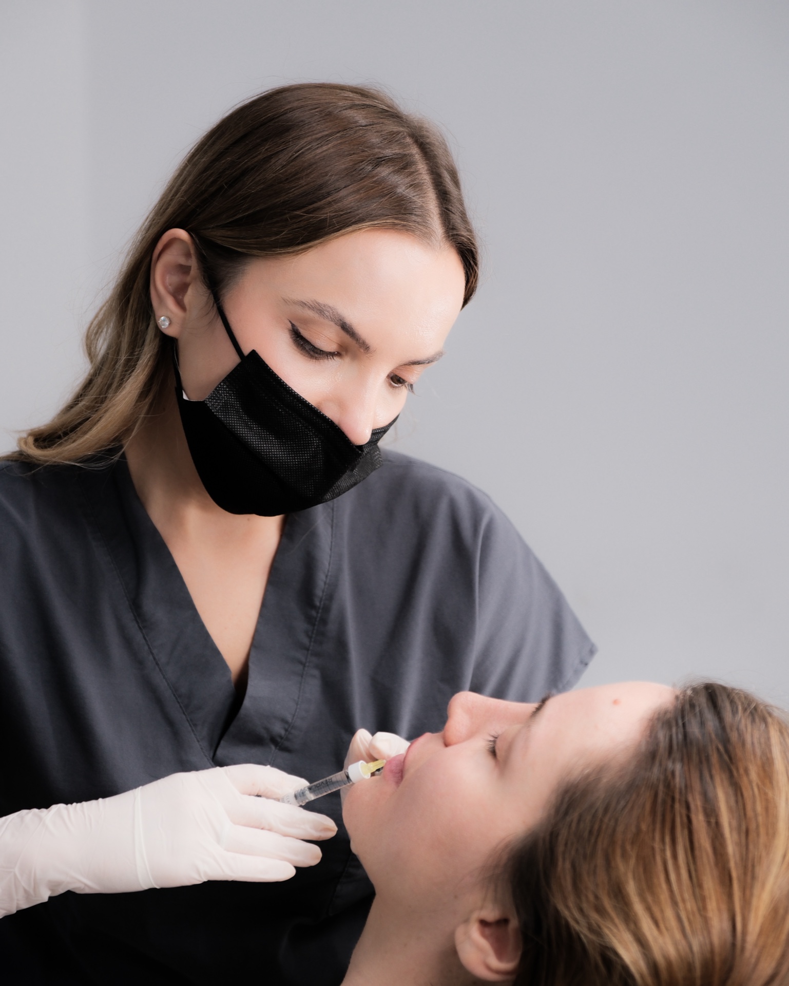 Risultato filler estetici