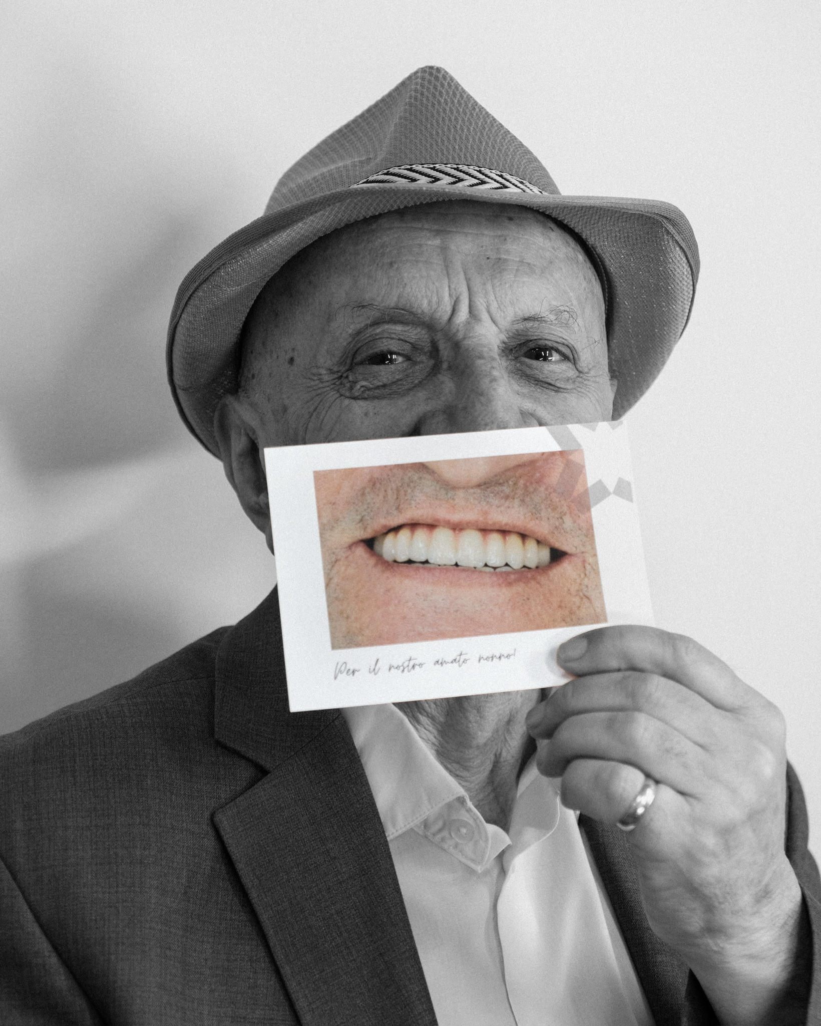 Nonno Bexhet con il suo nuovo sorriso — trattamento All-on-6