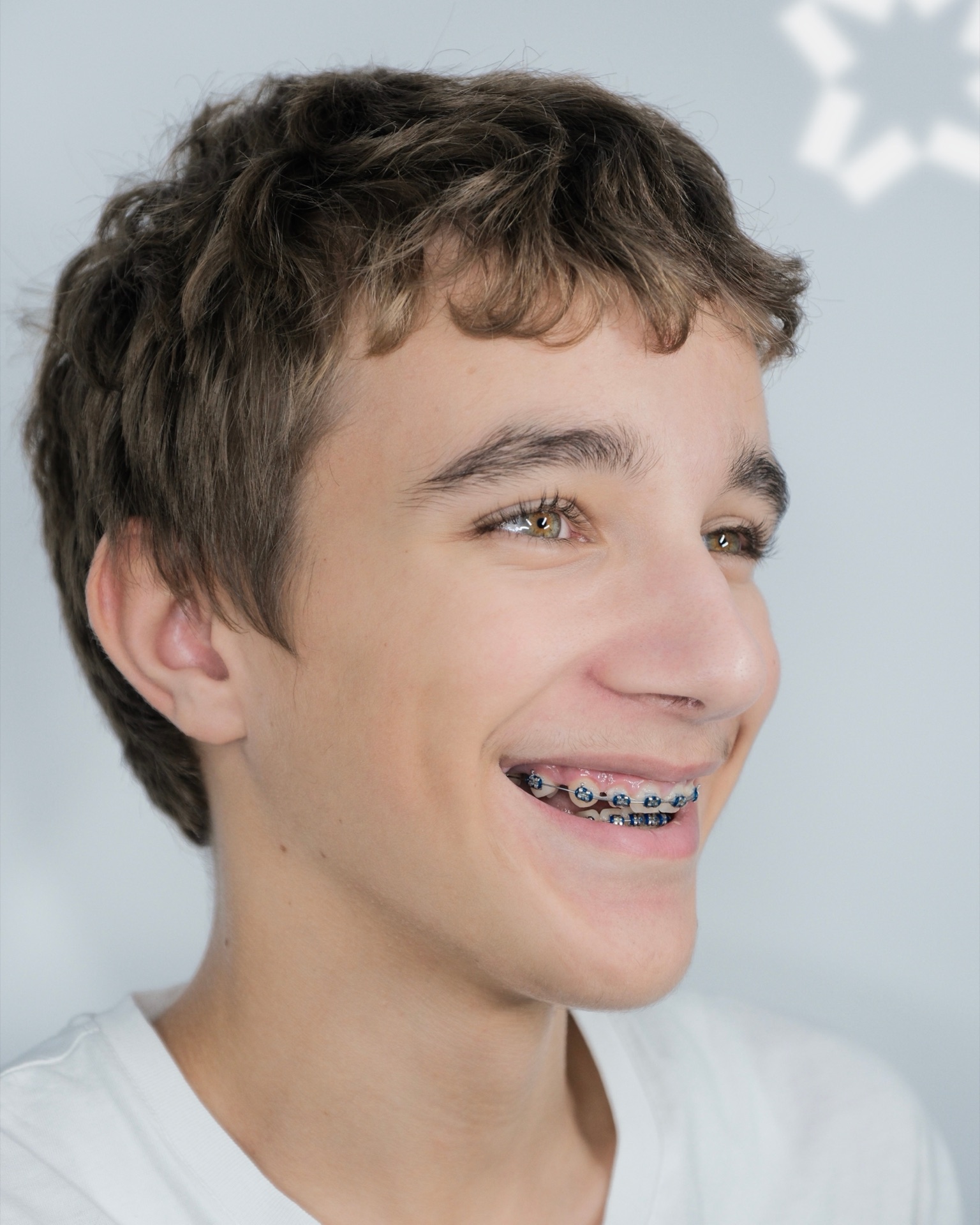 Paziente con braces